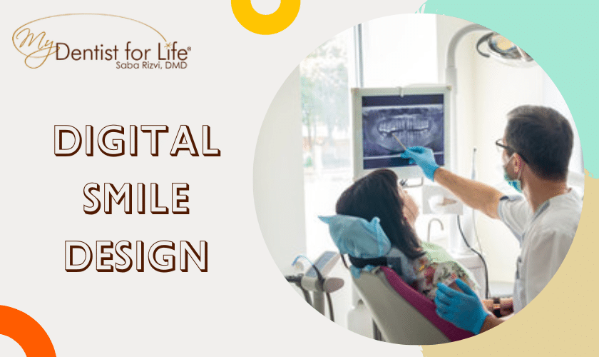 Digital Smile Design