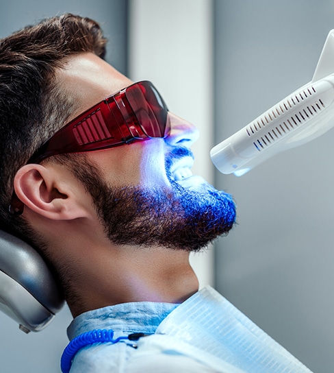 laser treatment plantation