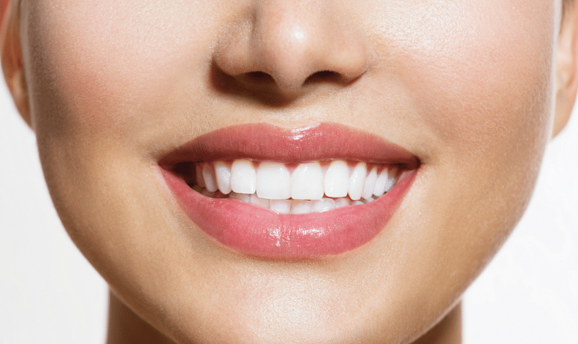 KöR® Whitening