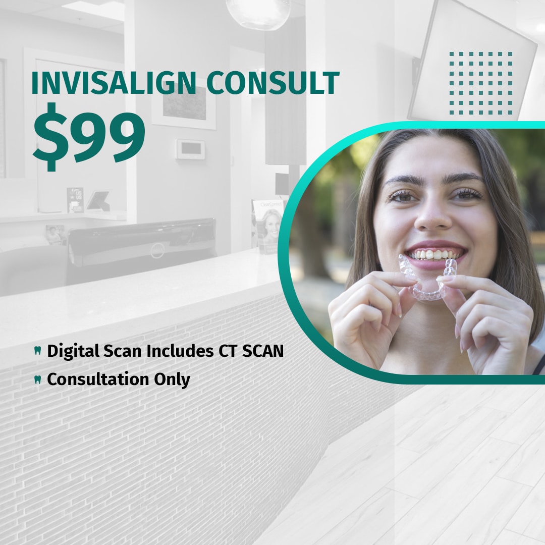 invisalign consult
