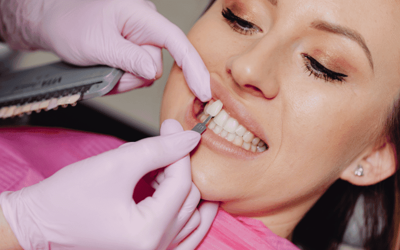Pain After Dental Veneers