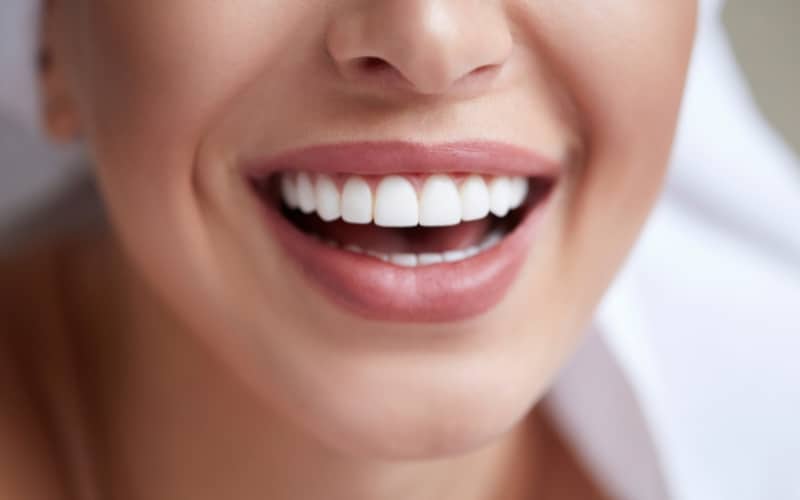 kör®-teeth-whitening-right-for-you